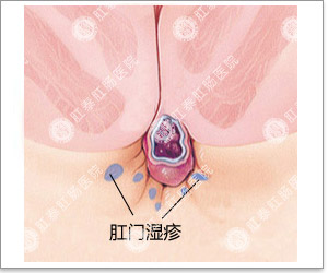 大連開發區肛腸醫院