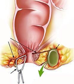 大連開發區肛腸醫院